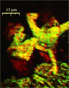 Two-Component Graded Deposition of Biomolecules with a Double-Barreled Nanopipette