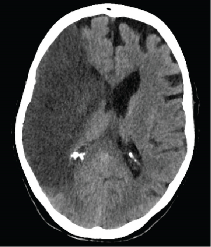 Details are in the caption following the image