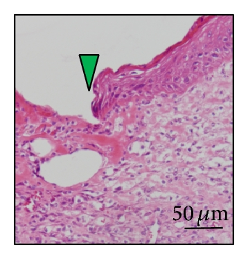 Details are in the caption following the image