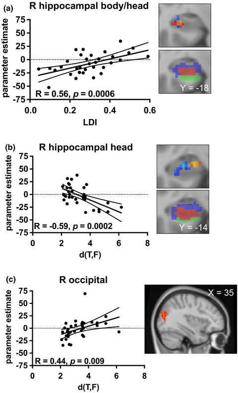 Neural substrates of mnemonic discrimination: A whole-brain fMRI investigation