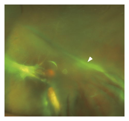 Details are in the caption following the image