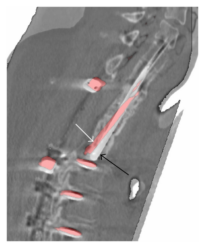 Details are in the caption following the image