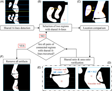 Automatic lumen segmentation using uniqueness of vascular connected region for intravascular optical coherence tomography