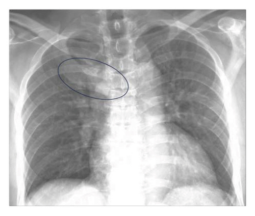 Details are in the caption following the image
