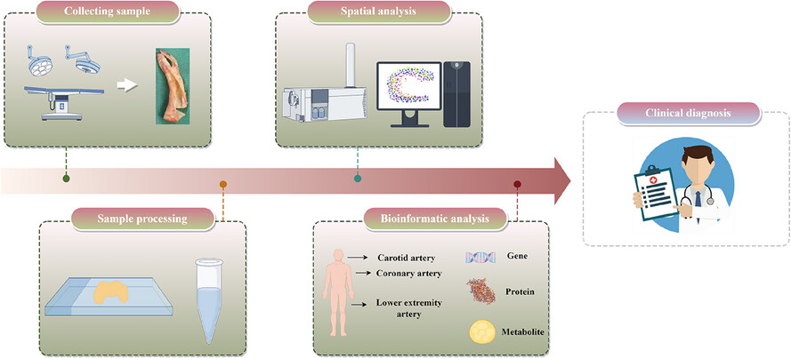 Spatial omics strategies for investigating human carotid atherosclerotic disease