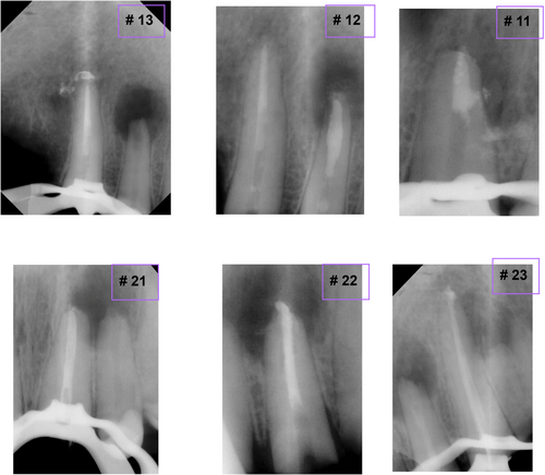 Details are in the caption following the image Details are in the caption following the image