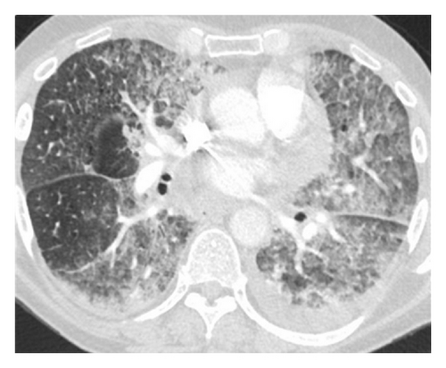 Details are in the caption following the image Details are in the caption following the image