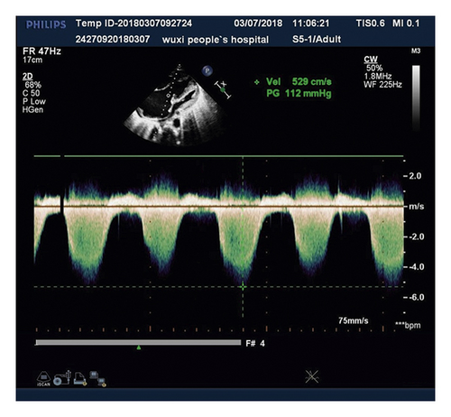 Details are in the caption following the image Details are in the caption following the image