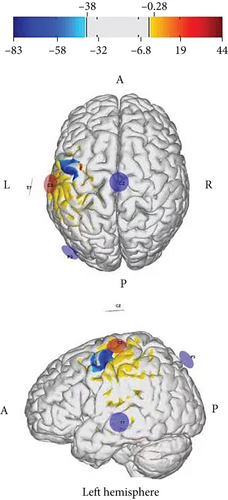 Details are in the caption following the image