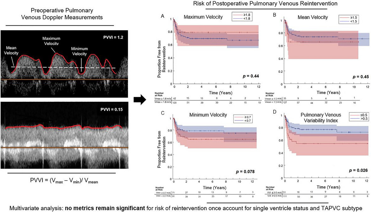 Predicting the Need for Pulmonary Venous Reintervention in Total Anomalous Pulmonary Venous Connection: The Role of Preoperative Echocardiographic Metrics