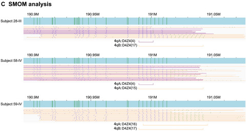 Clinical application of single-molecule optical mapping to a multigeneration FSHD1 pedigree