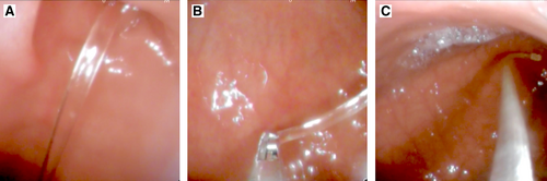 Details are in the caption following the image Details are in the caption following the image