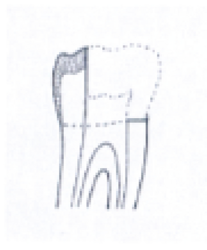 Details are in the caption following the image