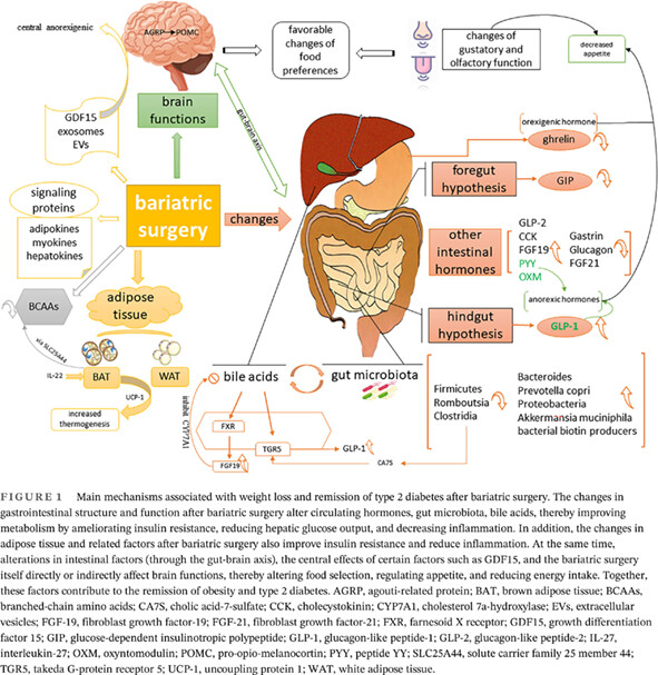 Mechanisms of bariatric surgery for weight loss and diabetes remission 减重手术减轻体重和缓解糖尿病的机制