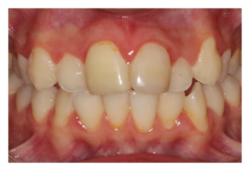 Details are in the caption following the image Details are in the caption following the image