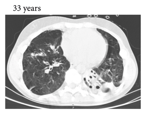 Details are in the caption following the image