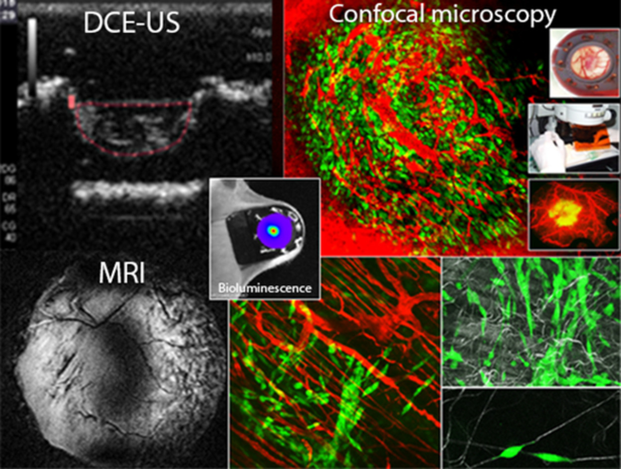 Multimodal imaging for tumour characterization from micro- to macroscopic level using a newly developed dorsal chamber designed for long-term follow-up
