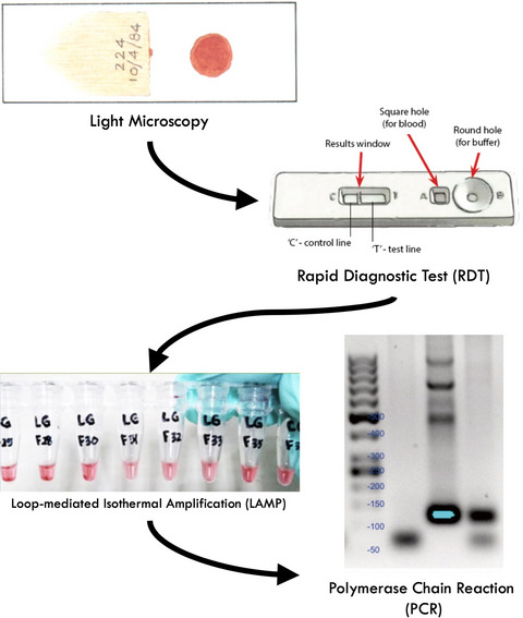 Malaria diagnostic update: From conventional to advanced method
