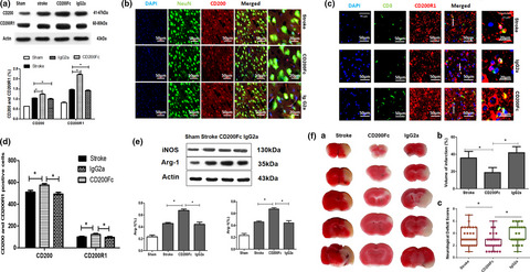 CD200-CD200R1 signaling pathway regulates neuroinflammation after stroke