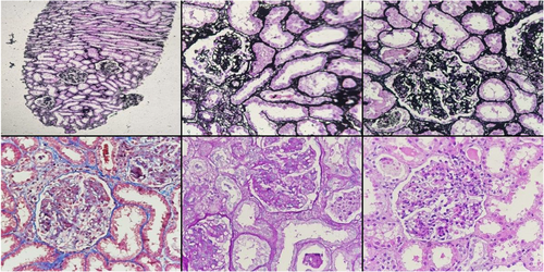 Details are in the caption following the image Details are in the caption following the image