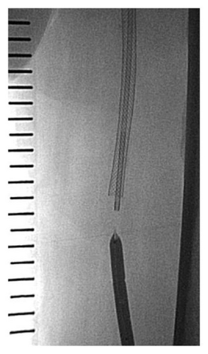 Details are in the caption following the image Details are in the caption following the image