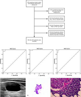 The influence of thyroid status, serum Tg, TSH, and TgAb on FNA-Tg in cervical metastatic lymph nodes of papillary thyroid carcinoma