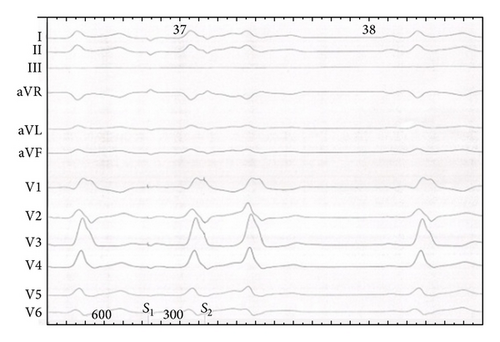Details are in the caption following the image Details are in the caption following the image
