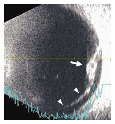 Details are in the caption following the image