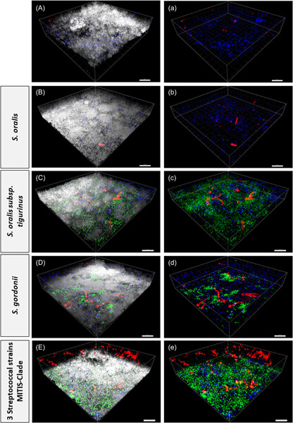 Dynamic interactions between Candida albicans and different streptococcal species in a multispecies oral biofilm