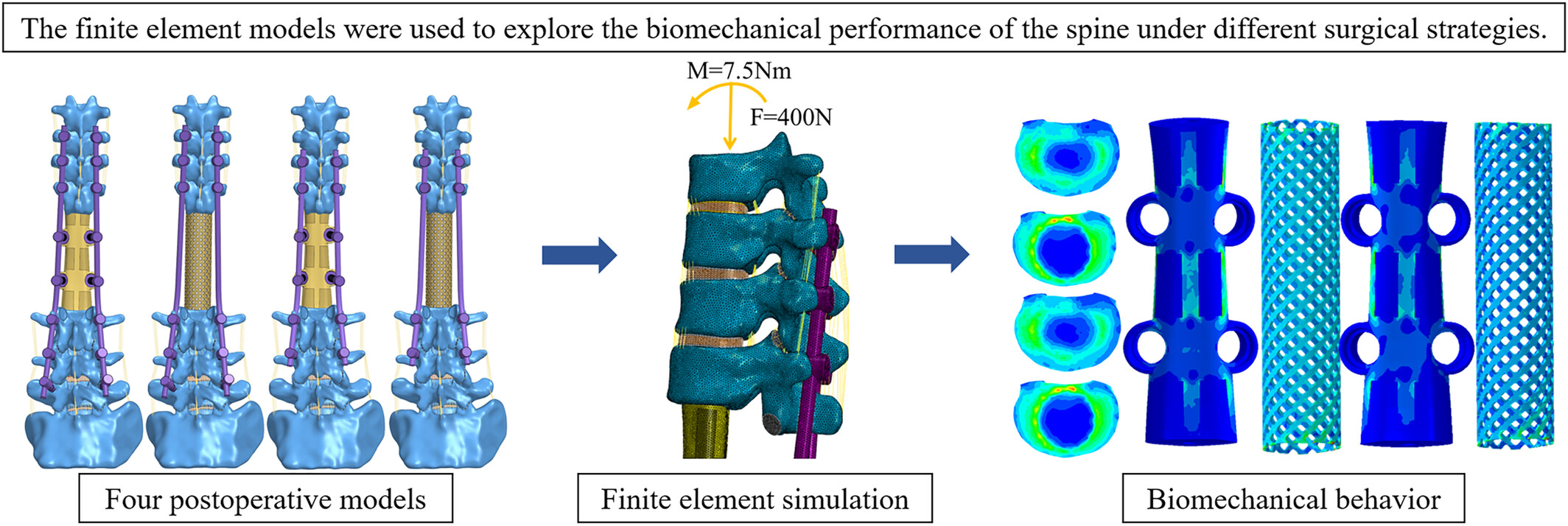 Biomechanical Effects of Different Prosthesis Types and Fixation Ranges in Multisegmental Total En Bloc Spondylectomy: A Finite Element Study