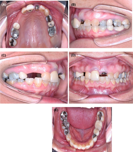 Details are in the caption following the image Details are in the caption following the image