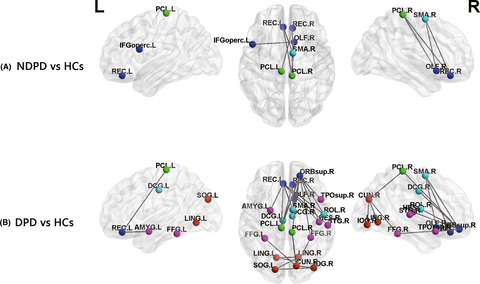 Alterations in intrinsic functional networks in Parkinson’s disease patients with depression: A resting-state functional magnetic resonance imaging study