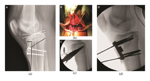 Details are in the caption following the image Details are in the caption following the image