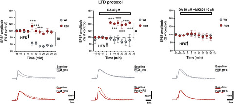 Corticostriatal synaptic plasticity alterations in the R6/1 transgenic mouse model of Huntington's disease