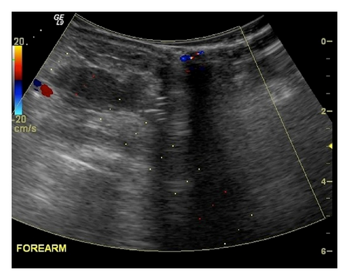 Details are in the caption following the image Details are in the caption following the image