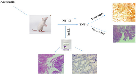 Arthrocen, an avocado-soy unsaponifiable agent, improves acetic acid-induced colitis in rat by inhibition of NF-kB signaling pathway