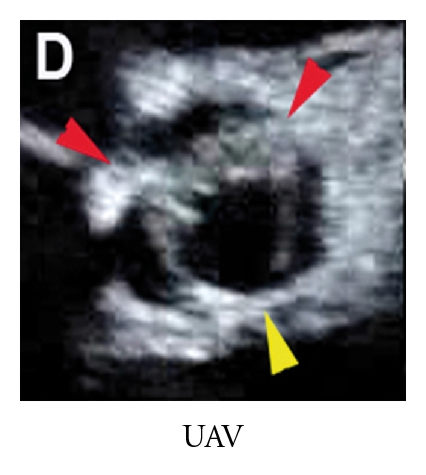 Details are in the caption following the image