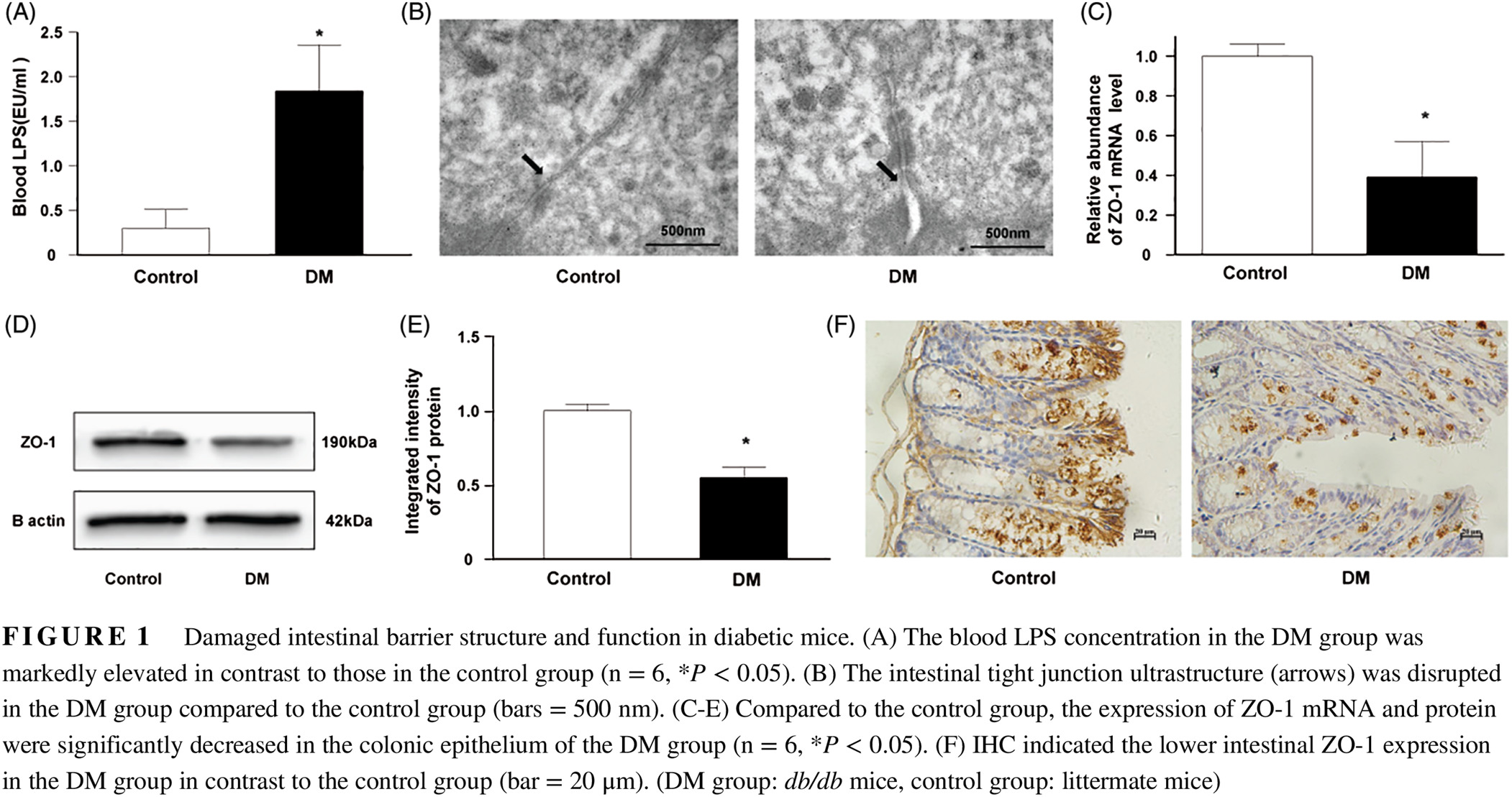 Faecalibacterium prausnitzii-derived microbial anti-inflammatory molecule regulates intestinal integrity in diabetes mellitus mice via modulating tight junction protein expression 普拉梭菌活性产物-微生物抗炎分子通过调控细胞紧密连接蛋白表达修复糖尿病小鼠肠道屏障
