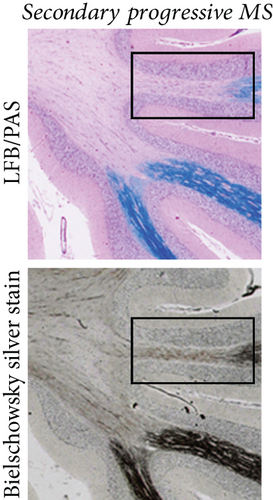 Details are in the caption following the image
