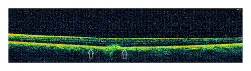 Details are in the caption following the image