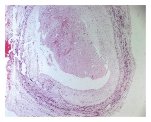 Details are in the caption following the image