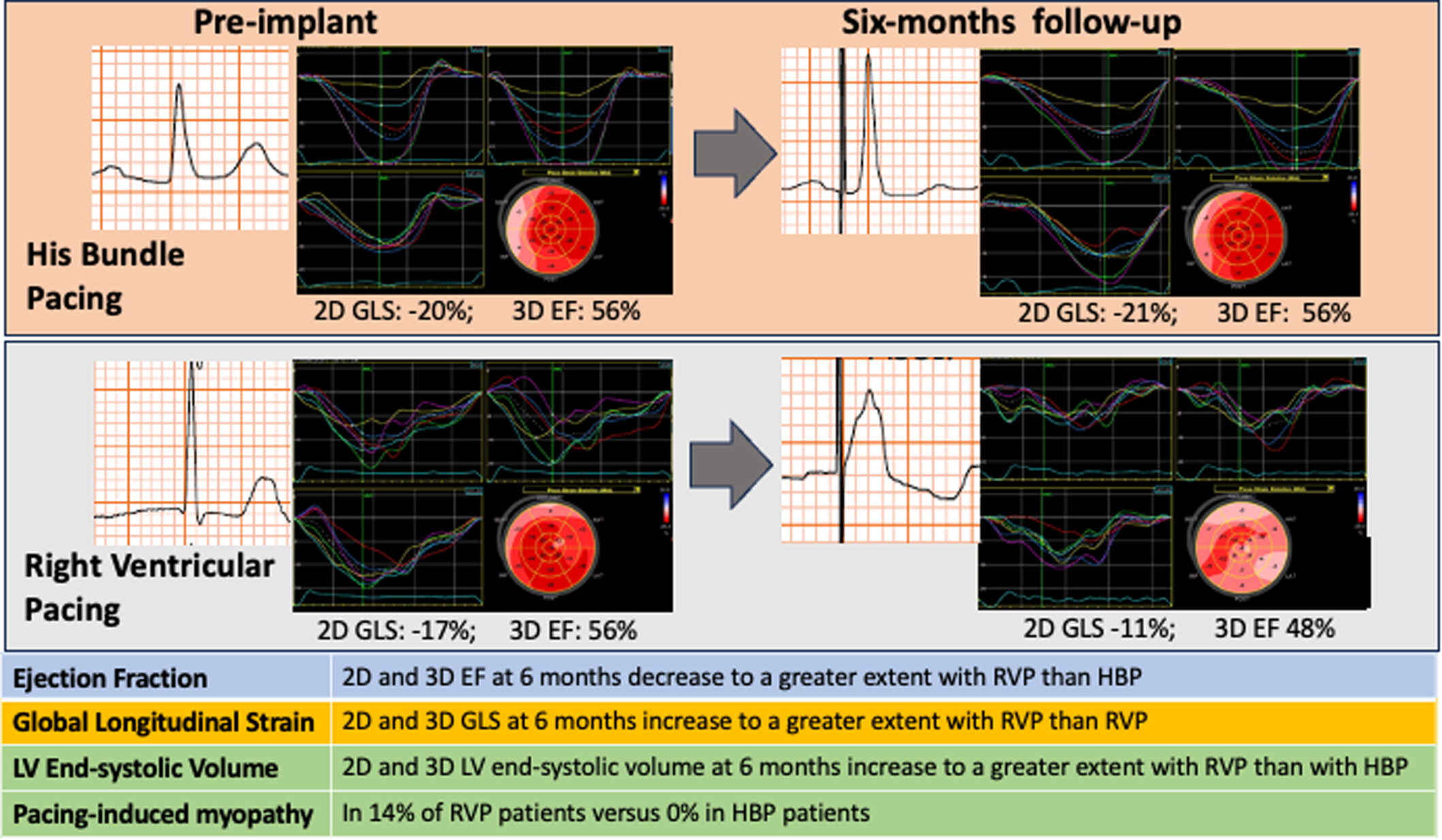 Left ventricular volumes and function in successful and failed His-BundLe Pacing. A comparative prospective study