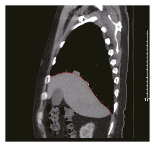 Details are in the caption following the image Details are in the caption following the image