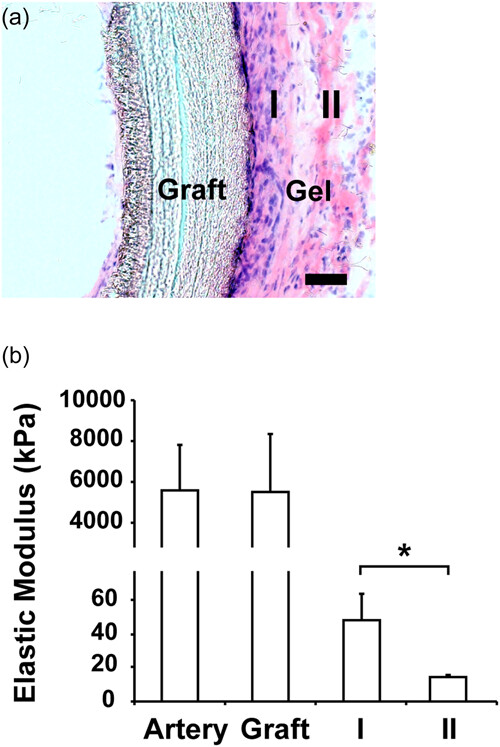 Matrix stiffness modulates the differentiation of neural crest stem cells in vivo