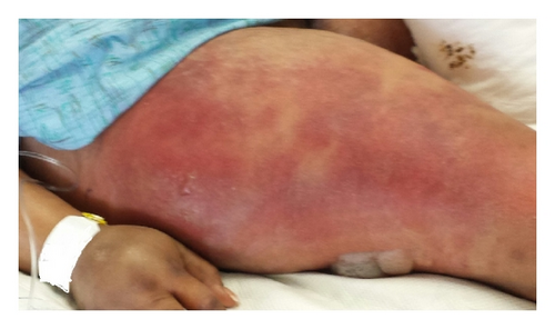 Details are in the caption following the image Details are in the caption following the image