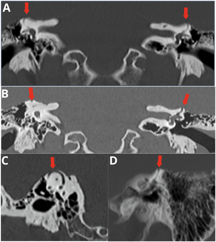 Details are in the caption following the image