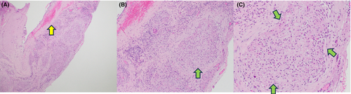 Details are in the caption following the image Details are in the caption following the image