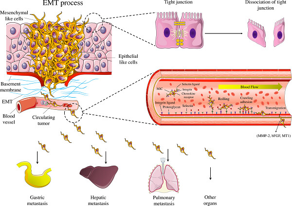 MicroRNAs and signaling networks involved in epithelial–mesenchymal transition
