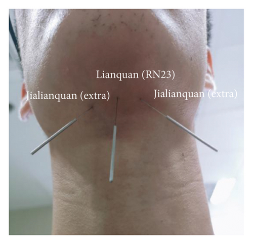 Details are in the caption following the image Details are in the caption following the image