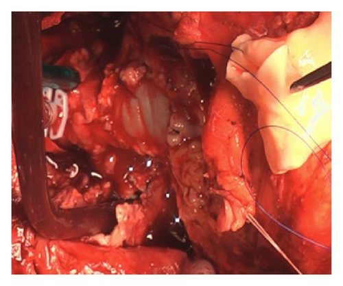 Details are in the caption following the image Details are in the caption following the image